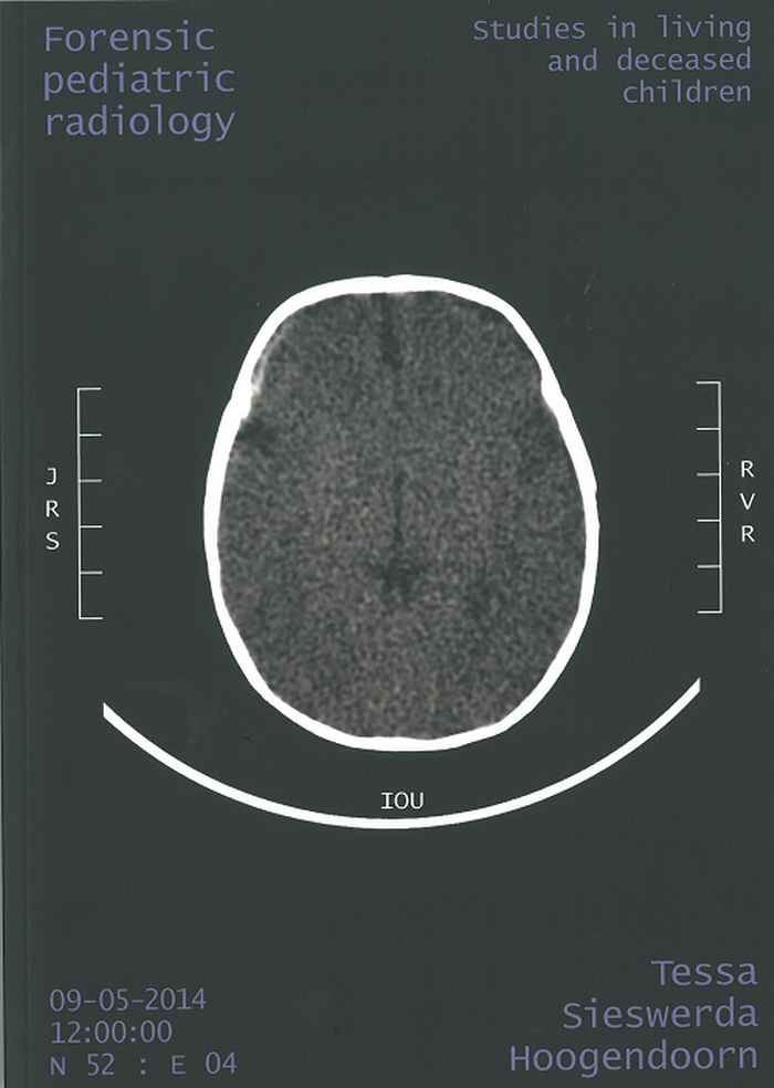 Tessa Sieswerda Hoogendoorn, Thesiscover Forenisc Pediatric Radiology, studies in living and deceased children