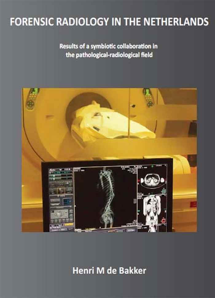 Cover Thesis Henri de Bakker